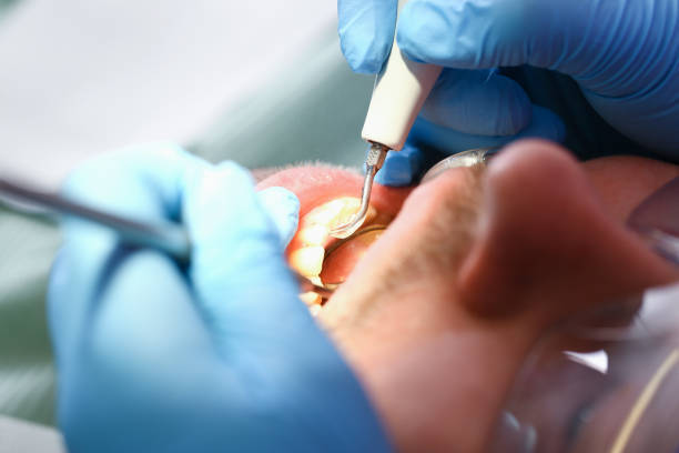 Best Emergency Dentist for Special Needs Patients in Larkspur, CA