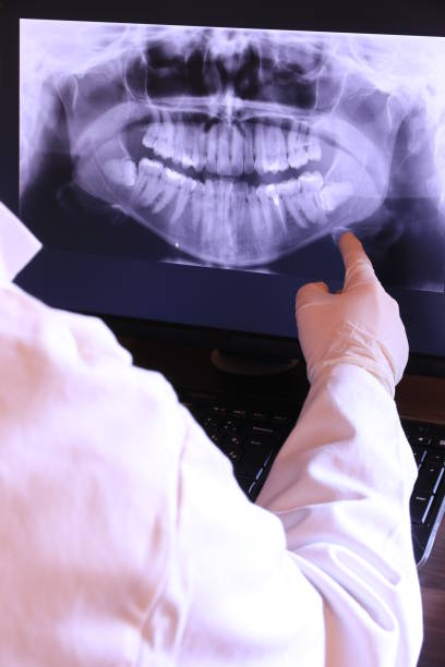 Best Emergency Cosmetic Dentistry in Larkspur, CA
