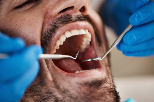 Best Holiday Emergency Dentist in Larkspur, CA